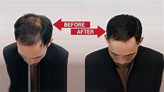 Hair Bonding Treatment