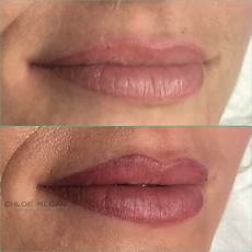 Lip Cosmetic