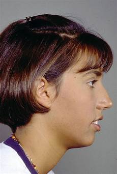 Bronzing Skin