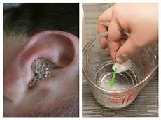 Buds Ear Cleaning