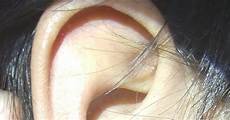 Buds Ear Cleaning