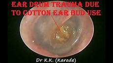 Cotton Ear Bud