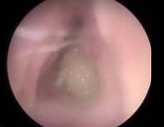 Cotton Ear Bud