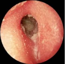 Cotton Ear Buds