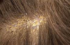 Cure Shampoo