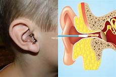 Ear Buds Cotton