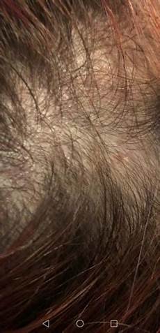 Ear