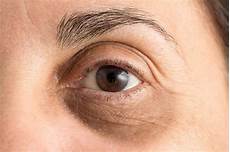 Eye Shampoo