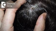 Flaky Scalp Treatment