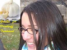 Garlic Almond Shampoos