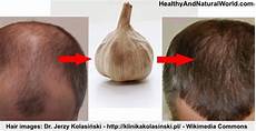 Garlic Shampoos