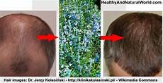 Hair Growth Shampoo