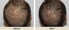 Hair Relaxing Treatment
