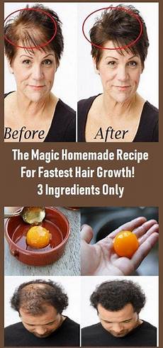 Hair Thickening Treatment