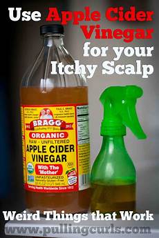 Itchy Scalp Treatment