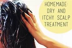 Itchy Scalp Treatment