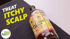 Itchy Scalp Treatment
