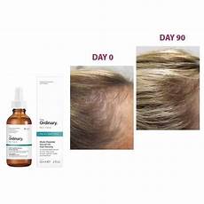 Multi Peptide Serum
