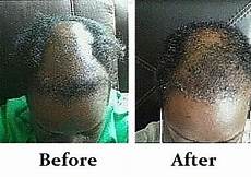 Natural Hair Serum