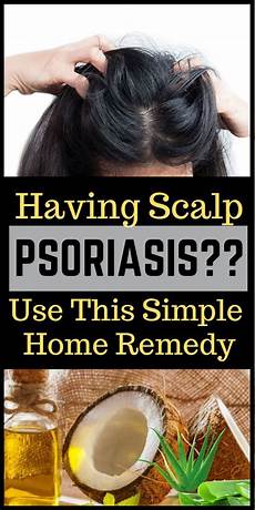 Natural Scalp Treatment