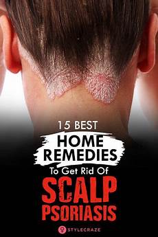 Natural Scalp Treatment