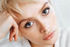 Oily Scalp Treatment