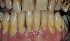 Oral Hygiene Provider