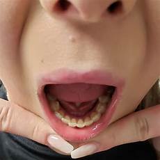 Oral Hygiene Provider