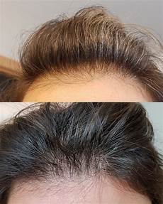 Ordinary Peptide Serum