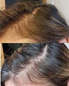 Ordinary Peptide Serum