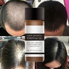 Organic Hair Treatment