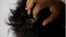 Scalp Cleansing Treatment