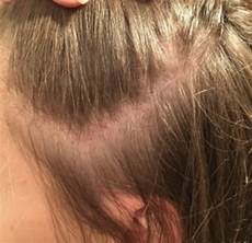 Scalp Shampoo