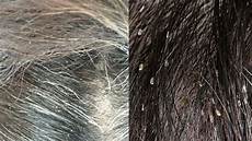 Scalp Shampoo