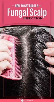 Scalp Treatment