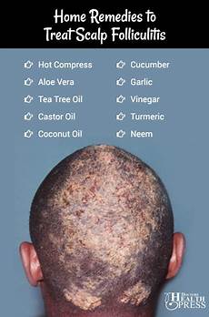 Scalp Treatment