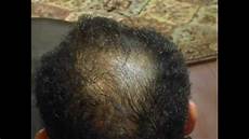 Shampoo for Women