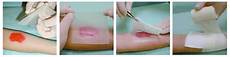 Sterile Cotton Buds