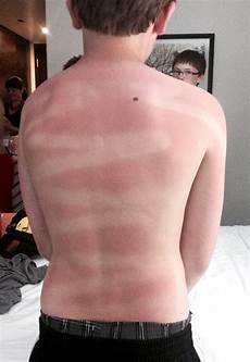Suntan Lotion