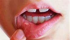 Toothpaste