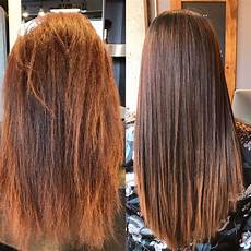 Treatment For Hair