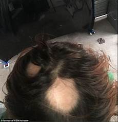 Wen Hair Loss